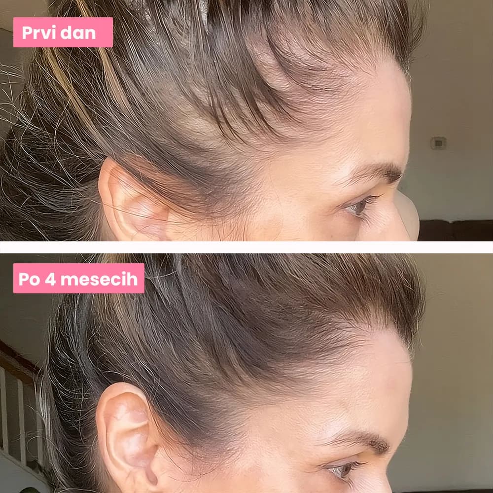 Grow & Glow transformation