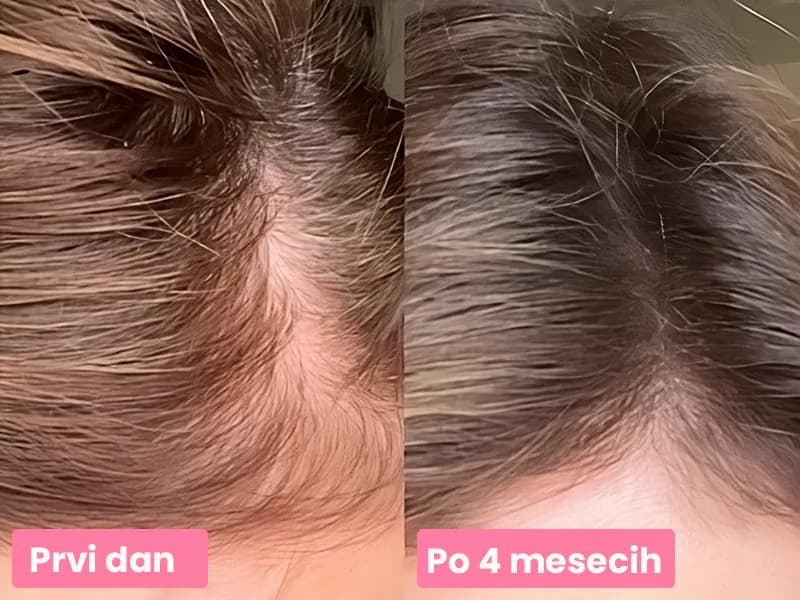 Majda's 4 MESEČNA TRANSFORMACIJA