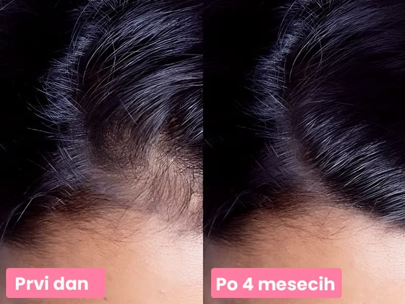 Eva's 4 MESEČNA TRANSFORMACIJA