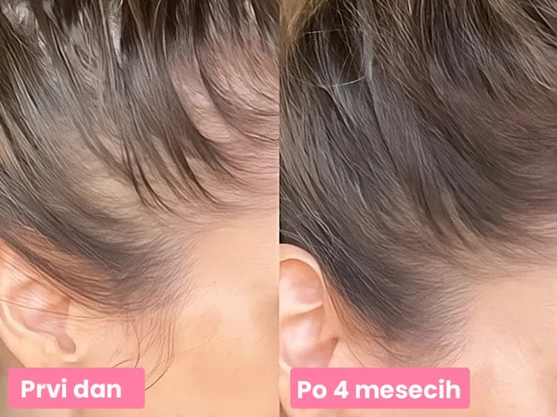 Mojca's 4 MESEČNA TRANSFORMACIJA